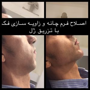 afkhami0 11