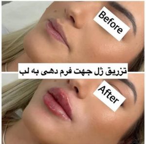 afkhami0 20