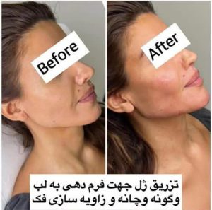 afkhami0 25