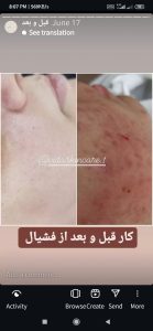 آموزشگاه ‏‏زیبایی ‏ویدارخ ‏کراتین ‏بافت ‏مو ‏و ‏شینیون ‏در ‏بلوار ‏استقلال ‏کرج 12
