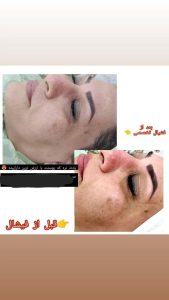 سالن ‏زیبایی ‏خانم ‏گل ‏میکروبلیدینگ ‏و ‏فیشیال ‏و ‏میکاپ ‏و ‏شینیون ‏در ‏تهران سلسبیل ‏شمالی 10
