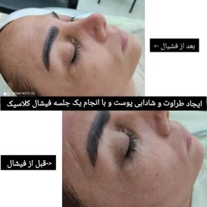 سالن ‏زیبایی ‏خانم ‏گل ‏میکروبلیدینگ ‏و ‏فیشیال ‏و ‏میکاپ ‏و ‏شینیون ‏در ‏تهران سلسبیل ‏شمالی 16
