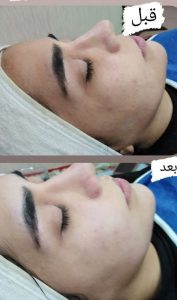 سالن ‏زیبایی ‏خانم ‏گل ‏میکروبلیدینگ ‏و ‏فیشیال ‏و ‏میکاپ ‏و ‏شینیون ‏در ‏تهران سلسبیل ‏شمالی 17