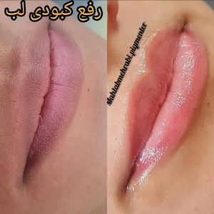 سالن ‏زیبایی ‏مهتاب ‏محرابی ‏خدمات ‏میکروبلیدینگ ‏و ‏فیبروز ‏و ‏هاشور ‏در ‏پیروزی 4 result result 1
