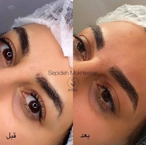 سپیده ‏مخلصیان ‏آرایش ‏دائم ‏صورت ‏فیبروز ‏میکروبلیدینگ ‏در ‏پونک ‏غرب ‏تهران 13