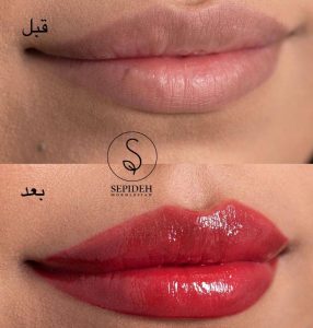 سپیده ‏مخلصیان ‏آرایش ‏دائم ‏صورت ‏فیبروز ‏میکروبلیدینگ ‏در ‏پونک ‏غرب ‏تهران 18