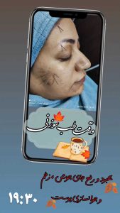 کلبه جادو طبیعت سبز خدمات تخصصی رفع جوش و لک و اسکالپ در قم گلزار شهدا