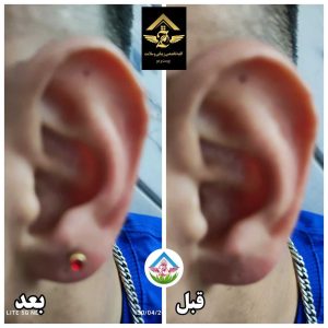 کلبه جادو طبیعت سبز خدمات تخصصی رفع جوش و لک و اسکالپ در قم گلزار شهدا 21