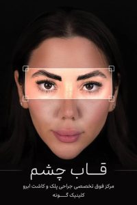 تخصصی گونه بلفاروپلاستی لیپوفیس تخلیه غبغب در تهران خیابان جردن