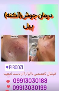کلینیک زیبایی دالیا خدمات لیزر و فیلر لب و فیشال در پیروزی