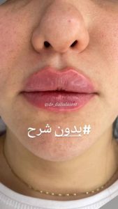 کلینیک زیبایی دالیا خدمات لیزر و فیلر لب و فیشال در پیروزی 2