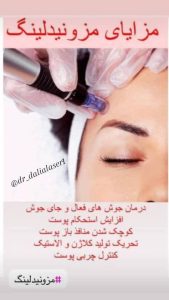 کلینیک زیبایی دالیا خدمات لیزر و فیلر لب و فیشال در پیروزی 5 1