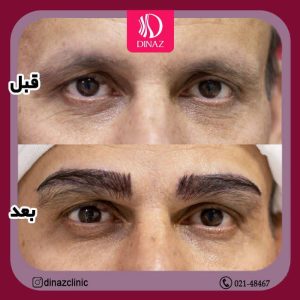 کلینیک ‏زیبایی ‏دیناز ‏خدمات ‏کاشت ‏مو ‏و ‏کاشت ‏ابرو ‏و ‏بلفاروپلاستی ‏در ‏تهران ‏سعادت ‏آباد