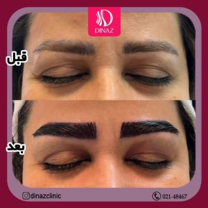 کلینیک ‏زیبایی ‏دیناز ‏خدمات ‏کاشت ‏مو ‏و ‏کاشت ‏ابرو ‏و ‏بلفاروپلاستی ‏در ‏تهران ‏سعادت ‏آباد