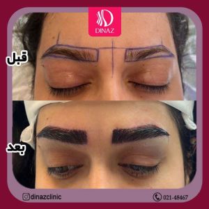 کلینیک ‏زیبایی ‏دیناز ‏خدمات ‏کاشت ‏مو ‏و ‏کاشت ‏ابرو ‏و ‏بلفاروپلاستی ‏در ‏تهران ‏سعادت ‏آباد