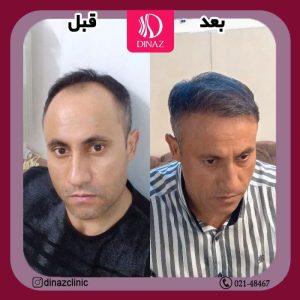 کلینیک ‏زیبایی ‏دیناز ‏خدمات ‏کاشت ‏مو ‏و ‏کاشت ‏ابرو ‏و ‏بلفاروپلاستی ‏در ‏تهران ‏سعادت ‏آباد