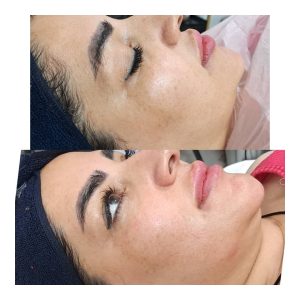 کلینیک ‏کالین ‏مرکز ‏لیزر ‏و ‏فیشال ‏تخصصی ‏آنزیم ‏تراپی ‏در تهران جنت آباد بلوار شاهین