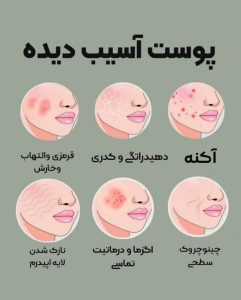 کلینیک ‏کالین ‏مرکز ‏لیزر ‏و ‏فیشال ‏تخصصی ‏آنزیم ‏تراپی ‏در تهران جنت آباد بلوار شاهین