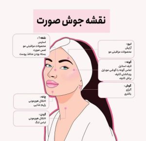کلینیک ‏کالین ‏مرکز ‏لیزر ‏و ‏فیشال ‏تخصصی ‏آنزیم ‏تراپی ‏در تهران جنت آباد بلوار شاهین