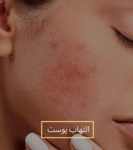 کلینیک ‏کالین ‏مرکز ‏لیزر ‏و ‏فیشال ‏تخصصی ‏آنزیم ‏تراپی ‏در تهران ستارخان سازمان آب