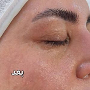 ‏مجرد ‏جوانسازی ‏پوست ‏پاکسازی ‏پوست ‏ماساژ ‏صورت ‏در ‏شرق ‏تهران ‏خیابان ‏نیروهوایی 11