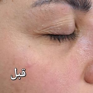 ‏مجرد ‏جوانسازی ‏پوست ‏پاکسازی ‏پوست ‏ماساژ ‏صورت ‏در ‏شرق ‏تهران ‏خیابان ‏نیروهوایی 12