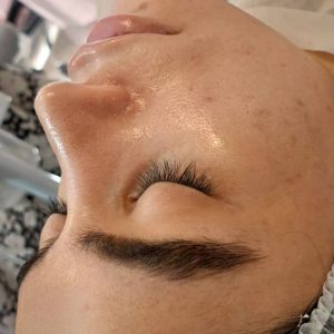 ‏مجرد ‏جوانسازی ‏پوست ‏پاکسازی ‏پوست ‏ماساژ ‏صورت ‏در ‏شرق ‏تهران ‏خیابان ‏نیروهوایی 4