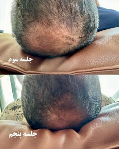 پهلوان پور خدمات و آموزش پاکسازی صورت و فشیال و مراقبت های پوستی در کرج مهر ویلا 12