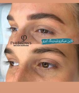 مرکز السا خدمات لیزر و زیبایی و پاکسازی پوست در تهران تجریش 11