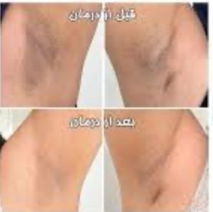 مرکز ‏پوست ‏و ‏مو ‏و ‏زیبایی ‏سیب ‏سبز ‏کربوکسی ‏تراپی ‏فیشال ‏جوانسازی ‏بوتاکس ‏در ‏قزوین ‏خیابان ‏دانشگاه