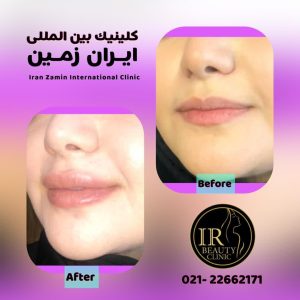کلینیک زیبایی ایران زمین کاشت مو تخصصی آقایان کاشت ابرو بانوان در الهیه 12