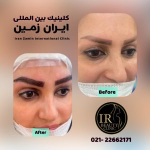 کلینیک زیبایی ایران زمین کاشت مو تخصصی آقایان کاشت ابرو بانوان در الهیه 13