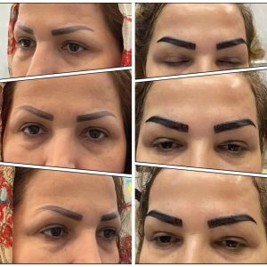 کلینیک زیبایی ایران زمین کاشت مو تخصصی آقایان کاشت ابرو بانوان در الهیه 7