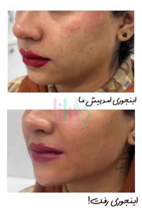 کلینیک ‏زیبایی ‏بارانا 5