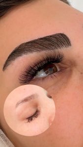 کلینیک ‏زیبایی ‏بهتا ‏خدمات ‏کاشت ‏تخصصی ‏مو ‏و ‏ابرو ‏و ‏تزریق ‏فیلر ‏و ‏لیزر ‏موهای ‏زائد ‏در ‏کرج ‏گوهردشت