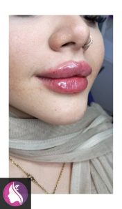 کلینیک ‏مرکز زیبایی ‏ستایش ‏‏نانسی ‏لیزر پوست ‏و بوتاکس ‏و هایفوتراپی در ‏میدان ‏جمهوری ‏نواب 2