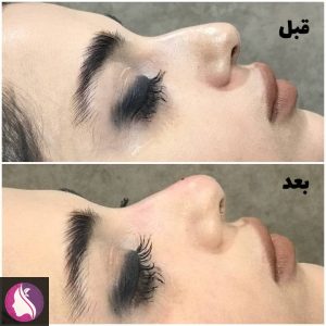 کلینیک ‏مرکز زیبایی ‏ستایش ‏‏نانسی ‏لیزر پوست ‏و بوتاکس ‏و هایفوتراپی در ‏میدان ‏جمهوری ‏نواب 4