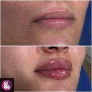 کلینیک ‏مرکز زیبایی ‏ستایش ‏‏نانسی ‏لیزر پوست ‏و بوتاکس ‏و هایفوتراپی در ‏میدان ‏جمهوری ‏نواب 7