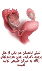 ‏ماما و طب ‏سنتی ‏ناهید ‏غیورآذر ‏درمان ‏تنبلی ‏تخمدان ‏یائسگی ‏زودرس ‏پریود ‏نامنظم ‏در ‏تهران ‏وردآورد 7