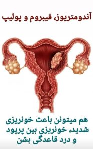 ‏ماما و طب ‏سنتی ‏ناهید ‏غیورآذر ‏درمان ‏تنبلی ‏تخمدان ‏یائسگی ‏زودرس ‏پریود ‏نامنظم ‏در ‏تهران ‏وردآورد 9