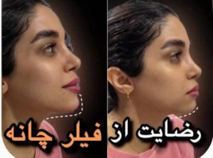 بیوتی لند تزریق چربی ژل بوتاکس لیزر موهای زائد تخلیه چربی در تهران پاسداران 10 3 1 1 1 1