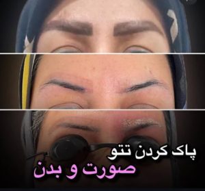 سحر بیوتی لند تزریق چربی ژل بوتاکس لیزر موهای زائد تخلیه چربی در تهران پاسداران 11 2 1 1 1 2