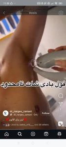 سحر بیوتی لند تزریق چربی ژل بوتاکس لیزر موهای زائد تخلیه چربی در تهران پاسداران 12 2 1 1