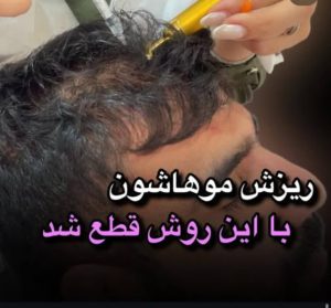 سحر بیوتی لند تزریق چربی ژل بوتاکس لیزر موهای زائد تخلیه چربی در تهران پاسداران 13 2 1 1 1 2 1 1 1