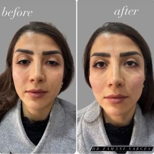 سحر بیوتی لند تزریق چربی ژل بوتاکس لیزر موهای زائد تخلیه چربی در تهران پاسداران 4 2 1 1 1 2