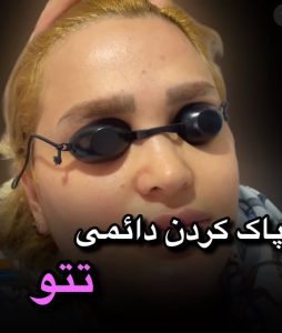 سحر بیوتی لند تزریق چربی ژل بوتاکس لیزر موهای زائد تخلیه چربی در تهران پاسداران 5 2 1 1 1 2 1 1 1