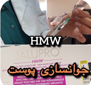 سحر بیوتی لند تزریق چربی ژل بوتاکس لیزر موهای زائد تخلیه چربی در تهران پاسداران 7 2 1 1