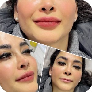 بیوتی لند تزریق چربی ژل بوتاکس لیزر موهای زائد تخلیه چربی در تهران پاسداران 8 3 1 1 1 1
