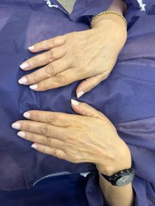 مرکز السا خدمات لیزر و زیبایی و پاکسازی پوست در تهران تجریش 18