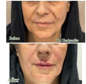 دکتر ‏قدیانی ‏فر ‏خدمات ‏ازون ‏تراپی ‏لایت ‏تراپی ‏پلاسما ‏تراپی ‏در ‏تهران ‏قیطریه 2
